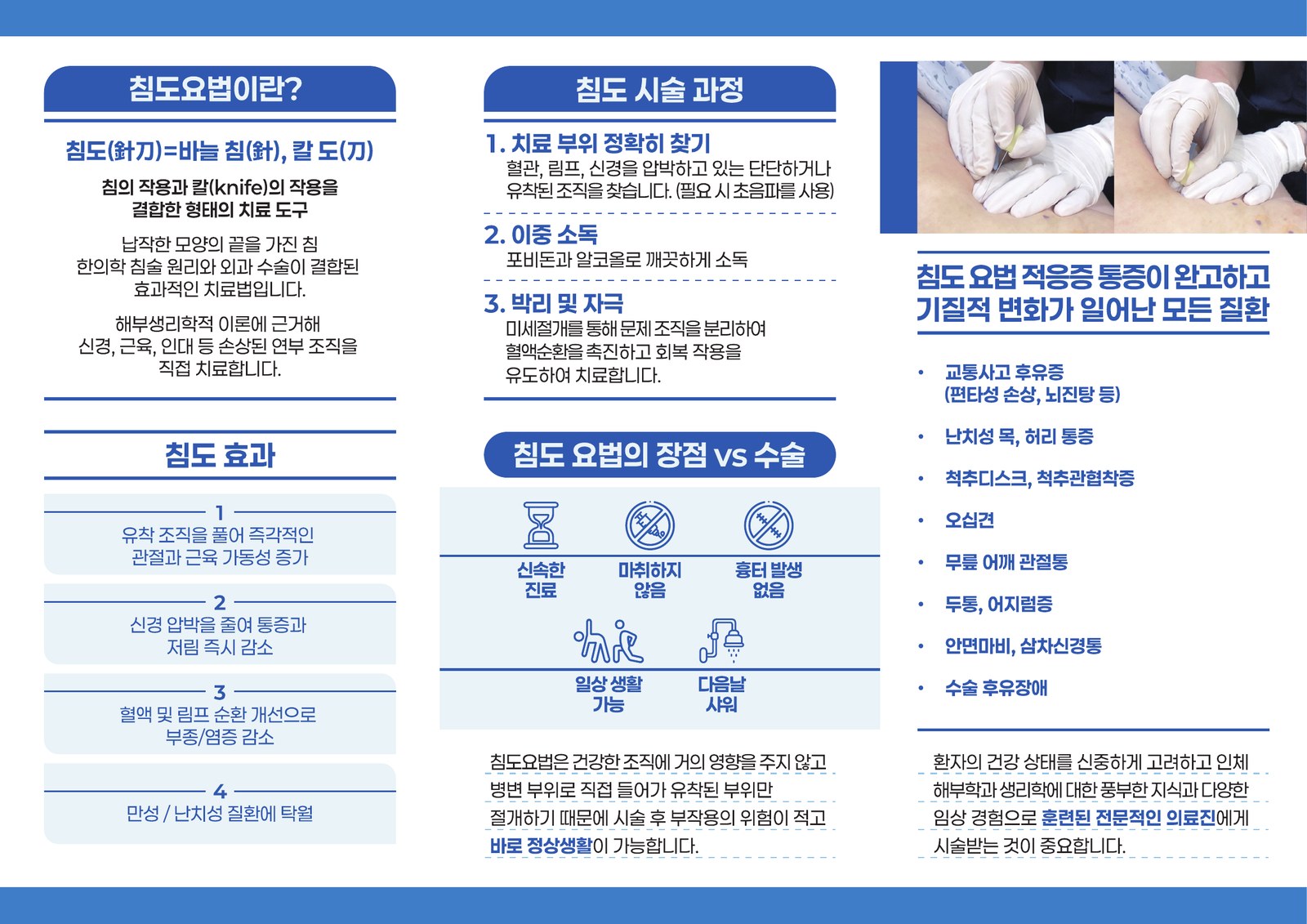 대한침도의학회 브로셔 — 침도요법의 정의, 침도 효과 4가지, 시술 과정 3단계, 수술과 비교한 장점, 적응증을 정리한 안내면